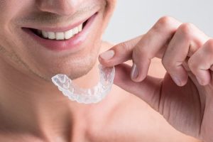 Best Dental Hospital in Bangalore