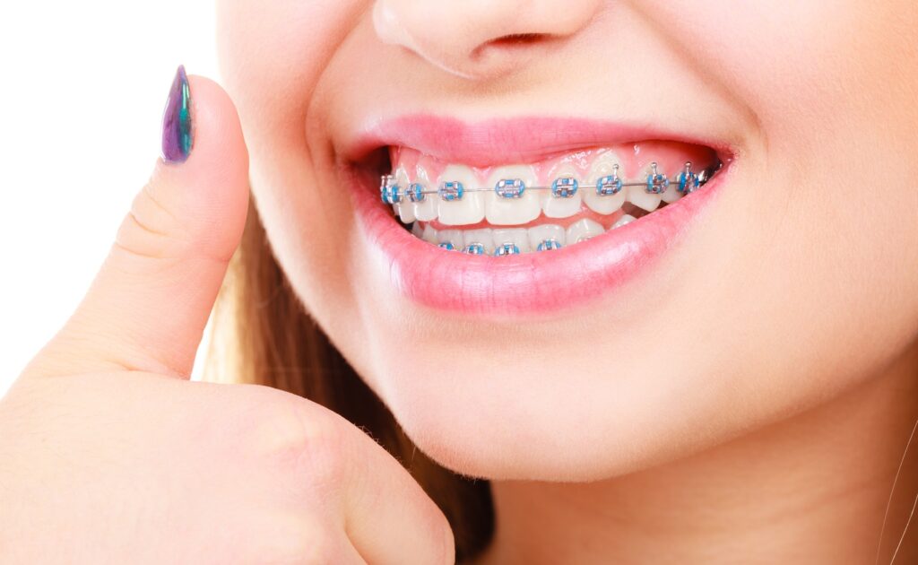 Best Orthodontists in Bangalore