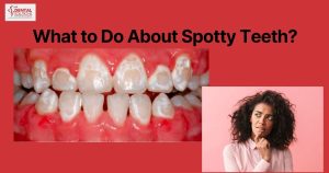 What to Do About Spotty Teeth?