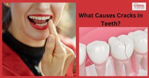Cracks in Teeth