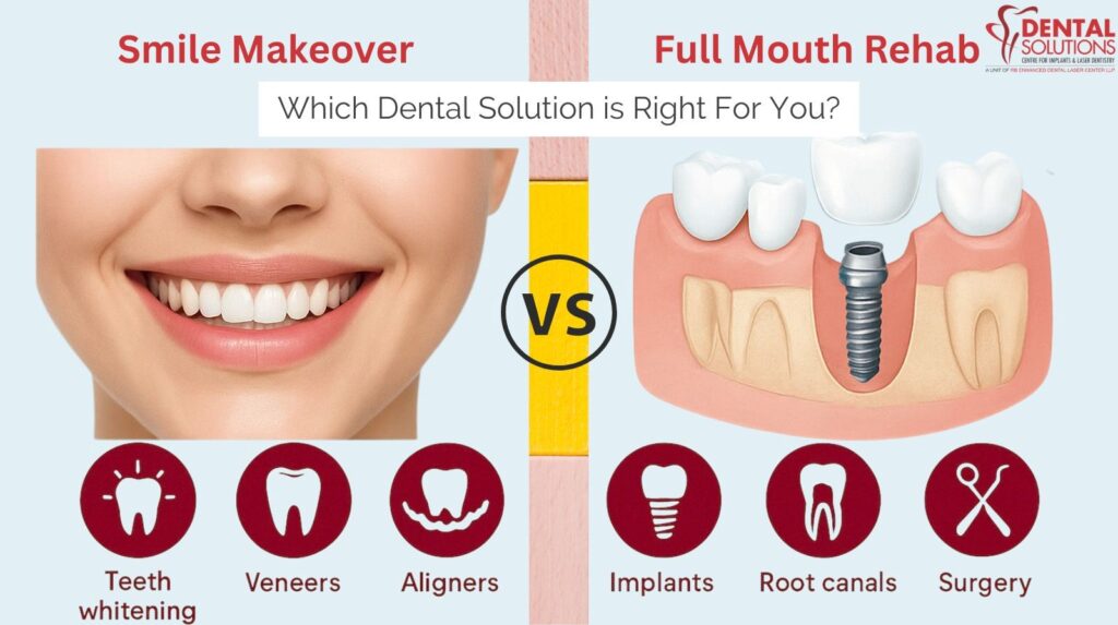 Comparison of Smile Makeover (whitening, veneers, aligners) versus Full Mouth Rehab (implants, root canals, surgery) showing the two dental solution paths.