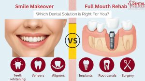 Comparison of Smile Makeover (whitening, veneers, aligners) versus Full Mouth Rehab (implants, root canals, surgery) showing the two dental solution paths.