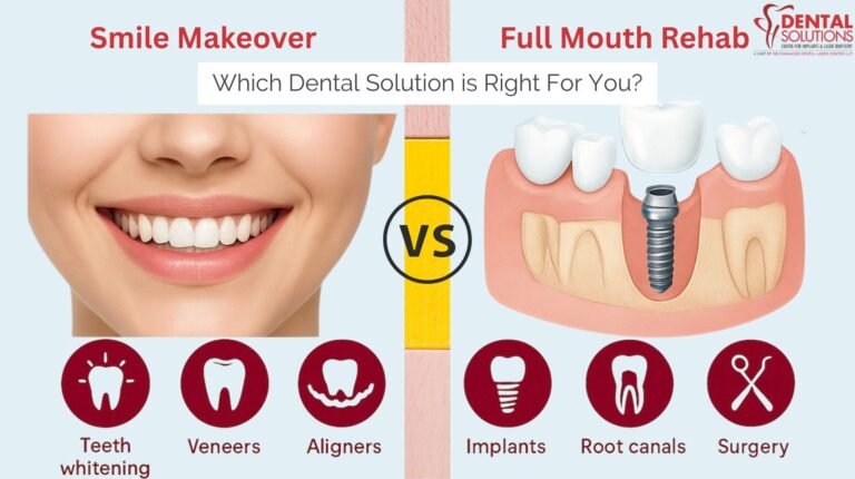 Comparison of Smile Makeover (whitening, veneers, aligners) versus Full Mouth Rehab (implants, root canals, surgery) showing the two dental solution paths.
