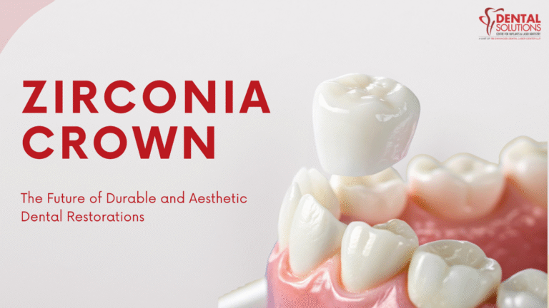 A Zirconia crown being placed on a tooth model, illustrating durable and aesthetic dental restoration.