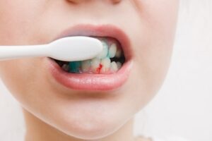 Association-Between-Gum-Disease-and-Diabetes
