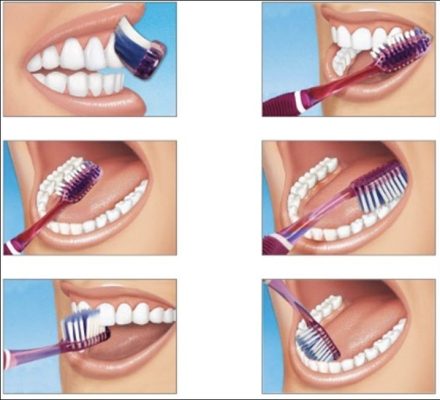 Brushing by Quadrant