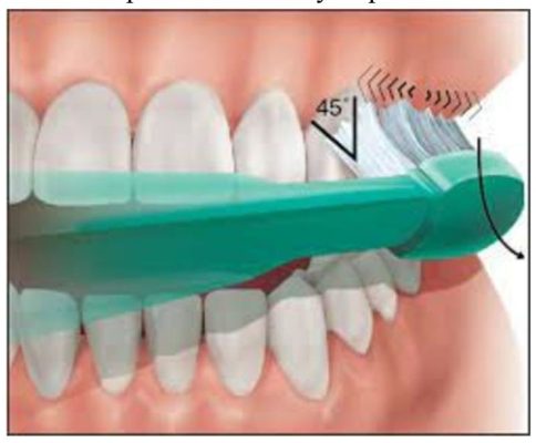 Correct Brushing Technique