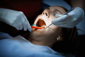 Dental-abscess-treatment