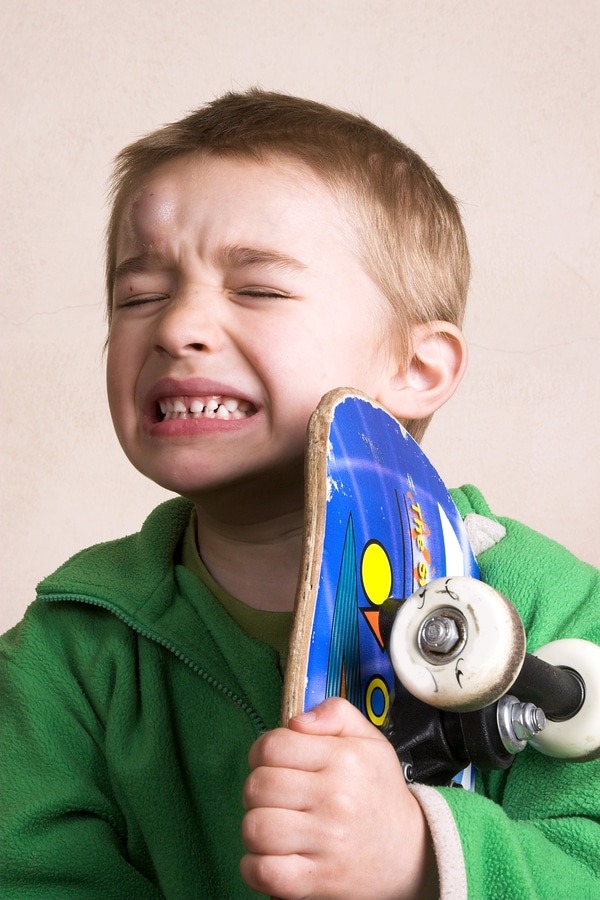 Dental-injury-skateboard