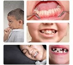 Smile makeovers Bangalore
