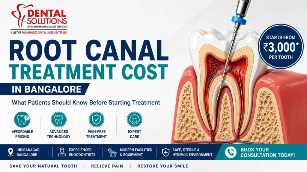 Illustration showing root canal treatment cost in Bangalore with a 3D tooth cross-section, dental procedure, and pricing guide by Dental Solutions Clinic.
