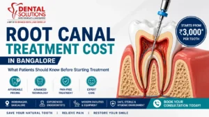 Illustration showing root canal treatment cost in Bangalore with a 3D tooth cross-section, dental procedure, and pricing guide by Dental Solutions Clinic.