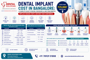 Dental Implant Cost in Bangalore at Dental Solutions Clinic – Complete Guide to Pricing, Procedure & Long-Term Benefits