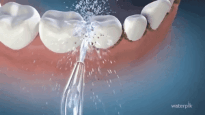 waterpik-flossing
